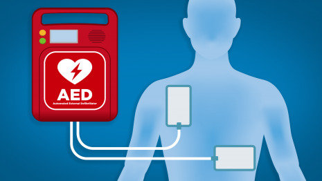 醫用護理床：黃金搶救4分鐘，使用CPR，AED指南！