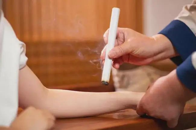 艾灸和拔罐的注意事項！